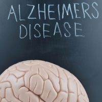 photo of brain and alzheimers education